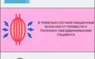 Ревматическая полимиалгия
