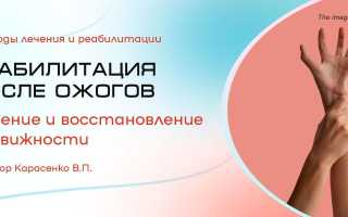 Реабилитация при ожогах: Стратегии физической и профессиональной терапии