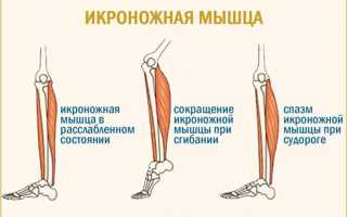 Откуда берутся судороги и что с ними делать