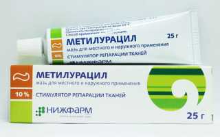 Применение мази Метилурацил при ожогах