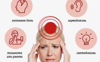 Мигрень и что на нее влияет?