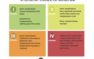 Ожоги: степени, лечение и первая помощь
