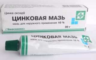 Как применять цинковую мазь при ожогах