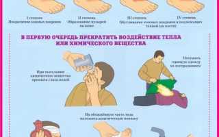 Первая помощь: как лечить ожоги
