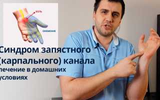 Лечим синдром запястного канала дома