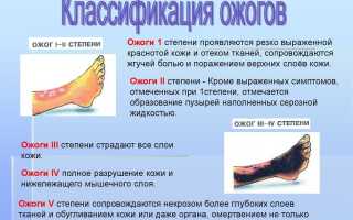 Классификация ожогов: Понимание различных степеней