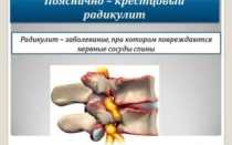 Ушиб крестцового отдела позвоночника при падении лечение