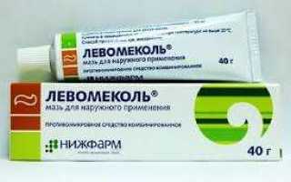 Как использовать мазь Левомеколь от ожога