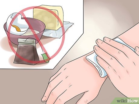 Изображение с названием Treat a Burn Step 12
