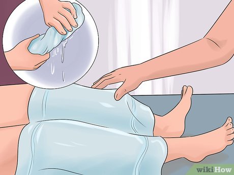 Изображение с названием Treat a Burn Step 17